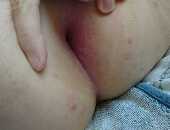 Peet18